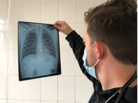 doctor looking at x-ray